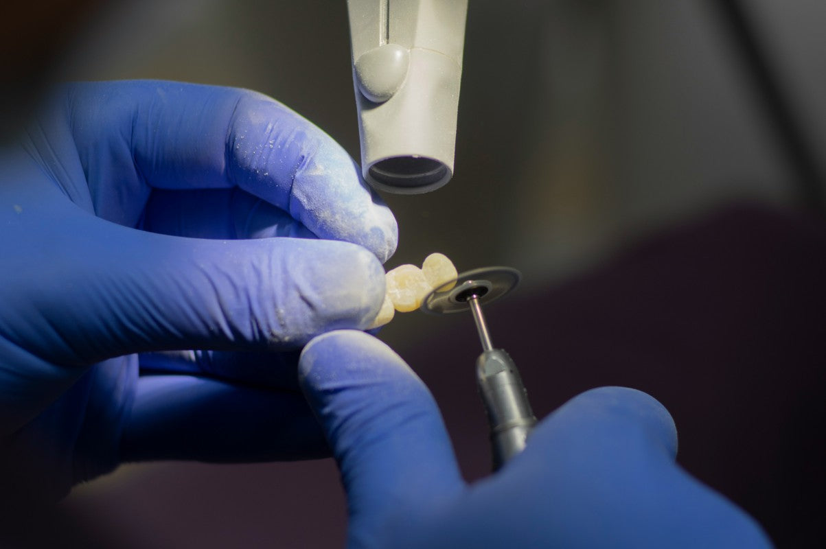 Shining 3D W20 Water-Washable Model Resin Beige: Simplifying Precision in Dental Model Production