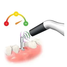 Implant Monitoring