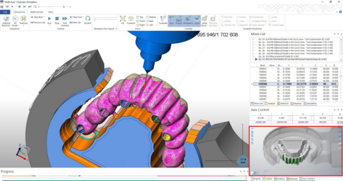 MILLBOX: The Dental CAM software for smart restorations