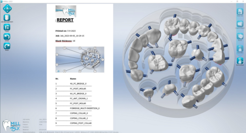 MILLBOX: The Dental CAM software for smart restorations