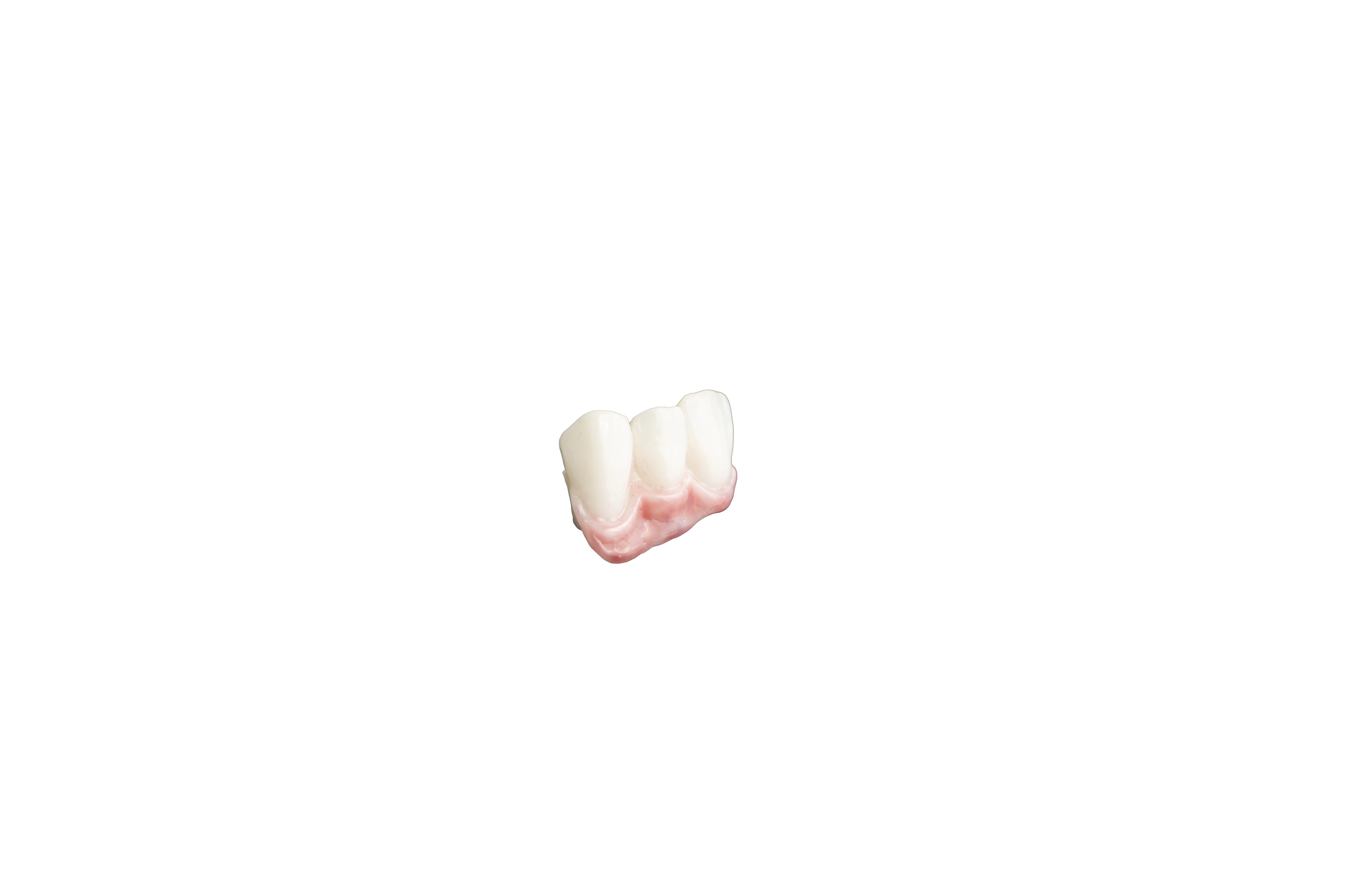 DentaFAB NanoCeram