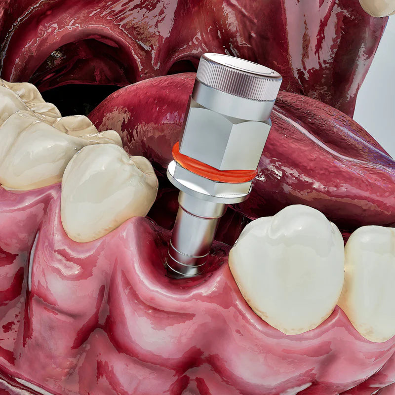 Implight Light-Guided Ratchet Driver