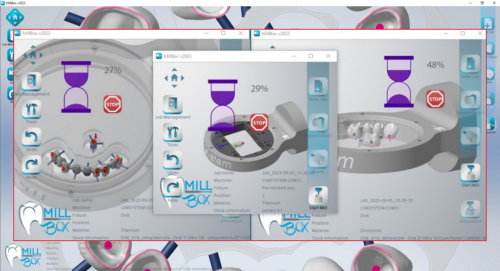 MILLBOX: The Dental CAM software for smart restorations