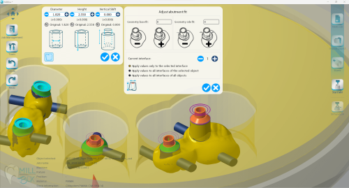 MILLBOX: The Dental CAM software for smart restorations