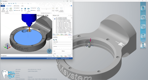 MILLBOX: The Dental CAM software for smart restorations