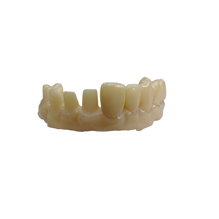 Dentca Temporary Crown & Bridge Resin