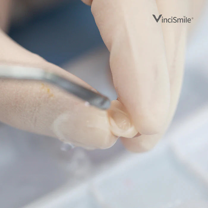 HUGE DENTAL USA HF-Etchant Hydrofluoric Acid Etching Gel