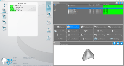 MILLBOX: The Dental CAM software for smart restorations