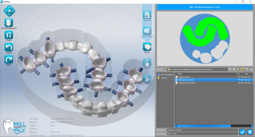 MILLBOX: The Dental CAM software for smart restorations