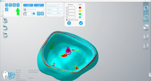 MILLBOX: The Dental CAM software for smart restorations