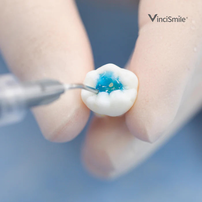 HUGE DENTAL USA P-Etchant Phosphoric Acid Etching Gel