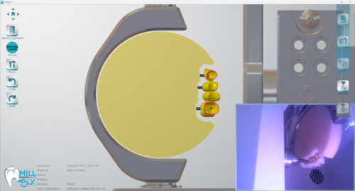MILLBOX: The Dental CAM software for smart restorations