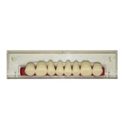 Porcelain Linear Occlusion Posteriors