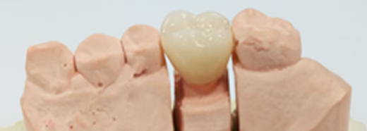 VATECH Perfit FS Zirconia Block – Pre-shaded, Fully Sintered, Crack Resistant