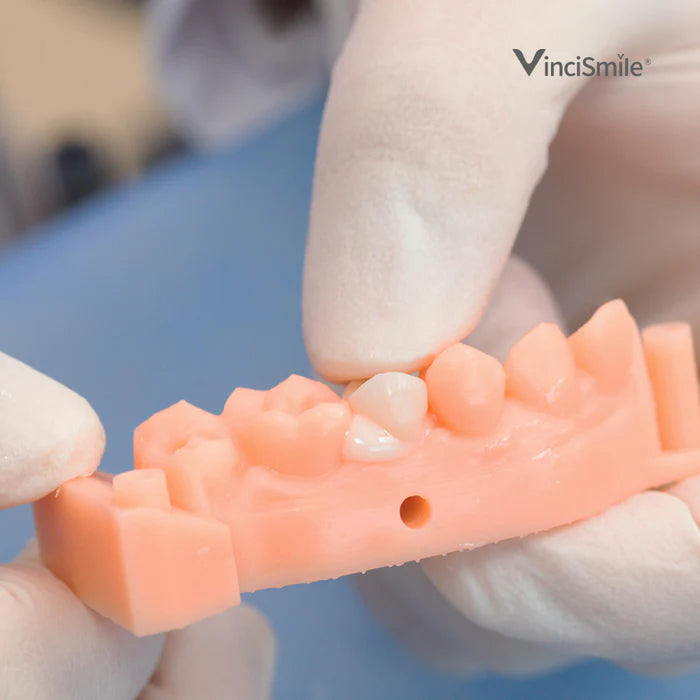 HUGE DENTAL USA TopCEM Dual Cure Resin Cement - 8g