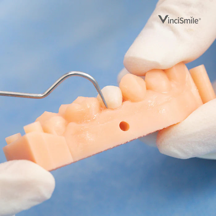 HUGE DENTAL USA TopCEM Dual Cure Resin Cement - 8g