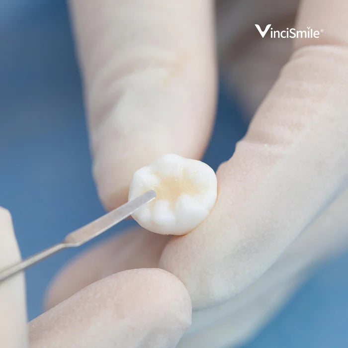 HUGE DENTAL USA TrusFIL Universal Composite Restorative