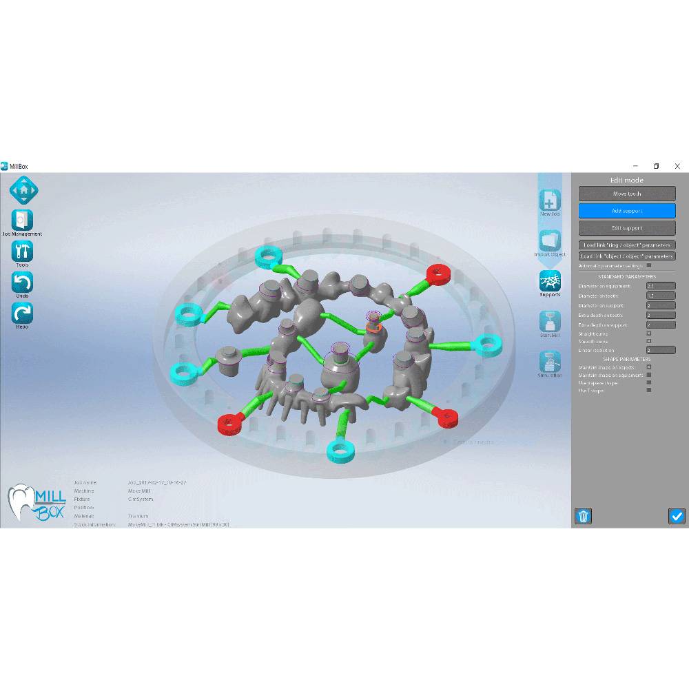 MILLBOX: The Dental CAM software for smart restorations