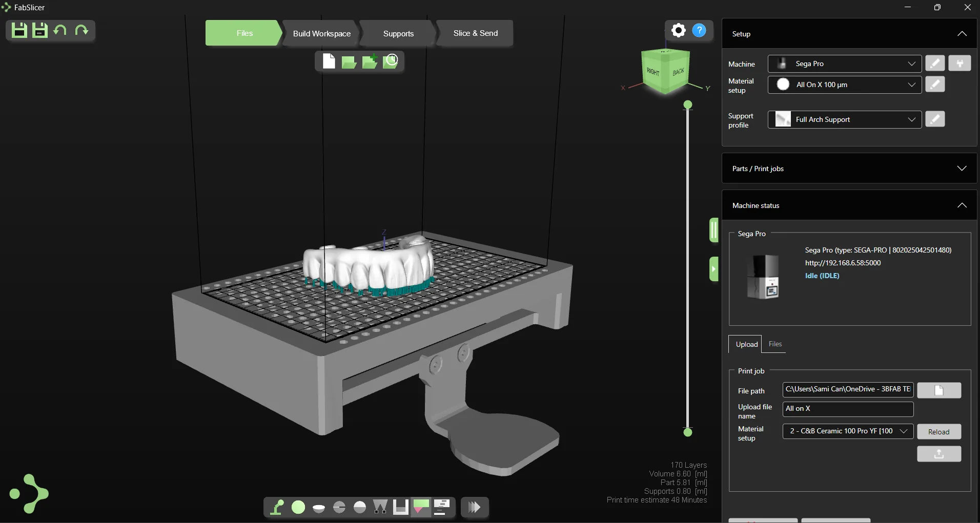 DentaSoft Slicer