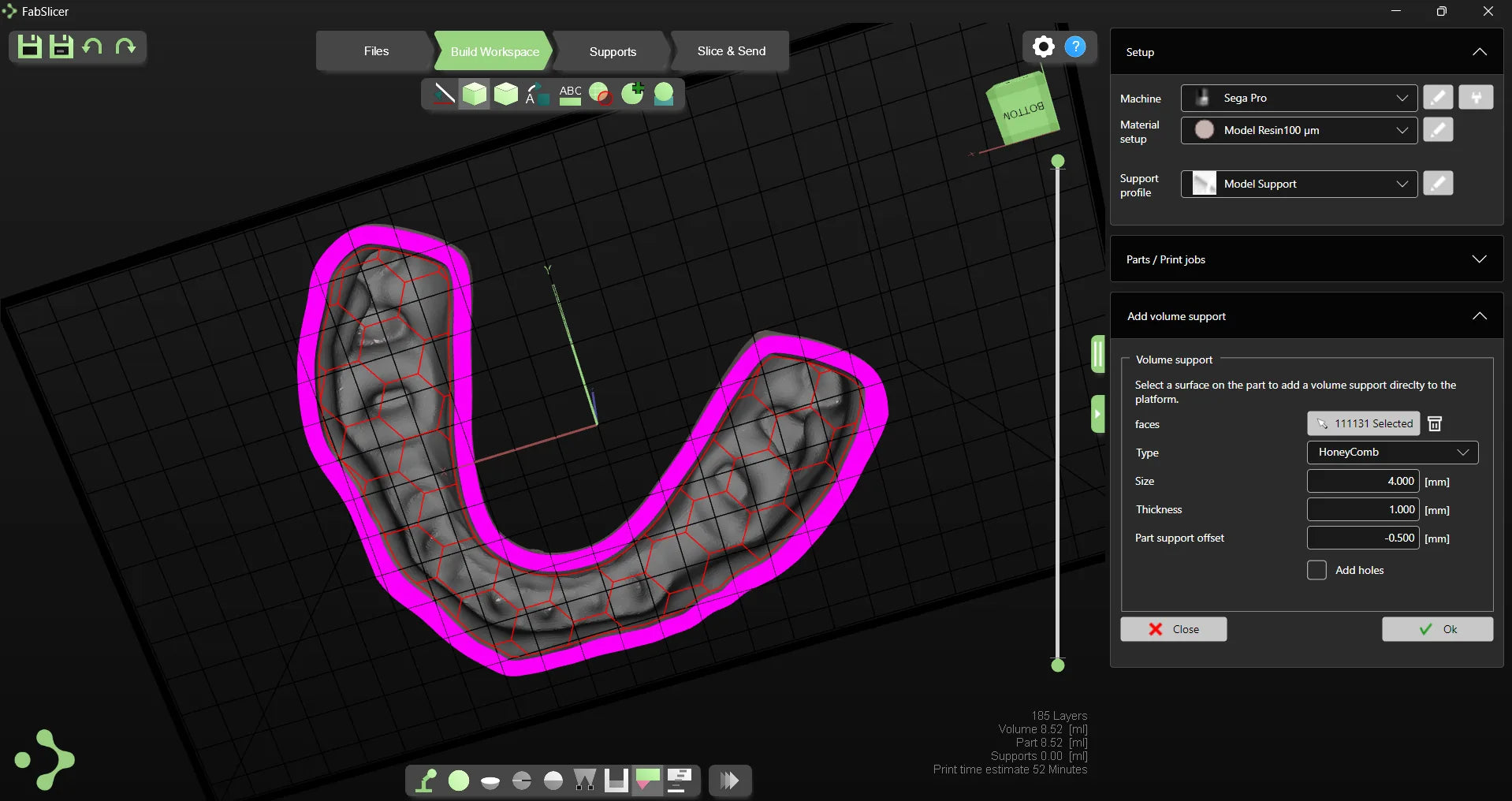DentaSoft Slicer