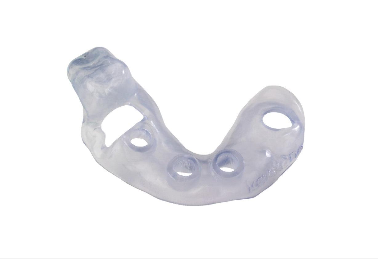 KeyPrint® KeyGuide - Starcona Dental Supply