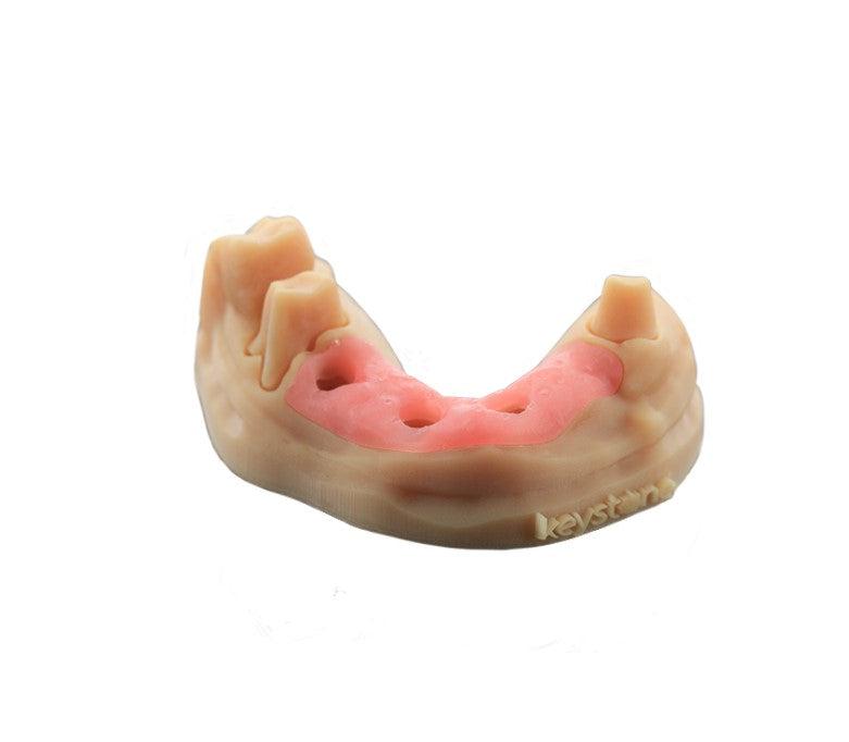 KeyPrint® KeyMask Resin