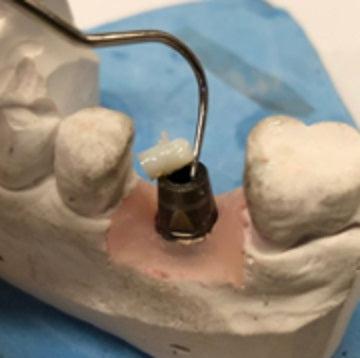 Liquid Magic Resin Barrier Kit