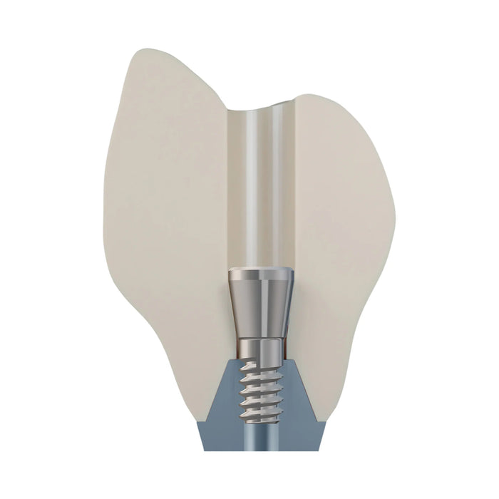 DSI EvoConnect M1.4 - Direct Сonnection Screws for Multi-Unit Abutments