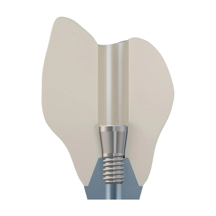 DSI EvoConnect M1.7 - Direct Сonnection Screws for Multi-Unit Abutments