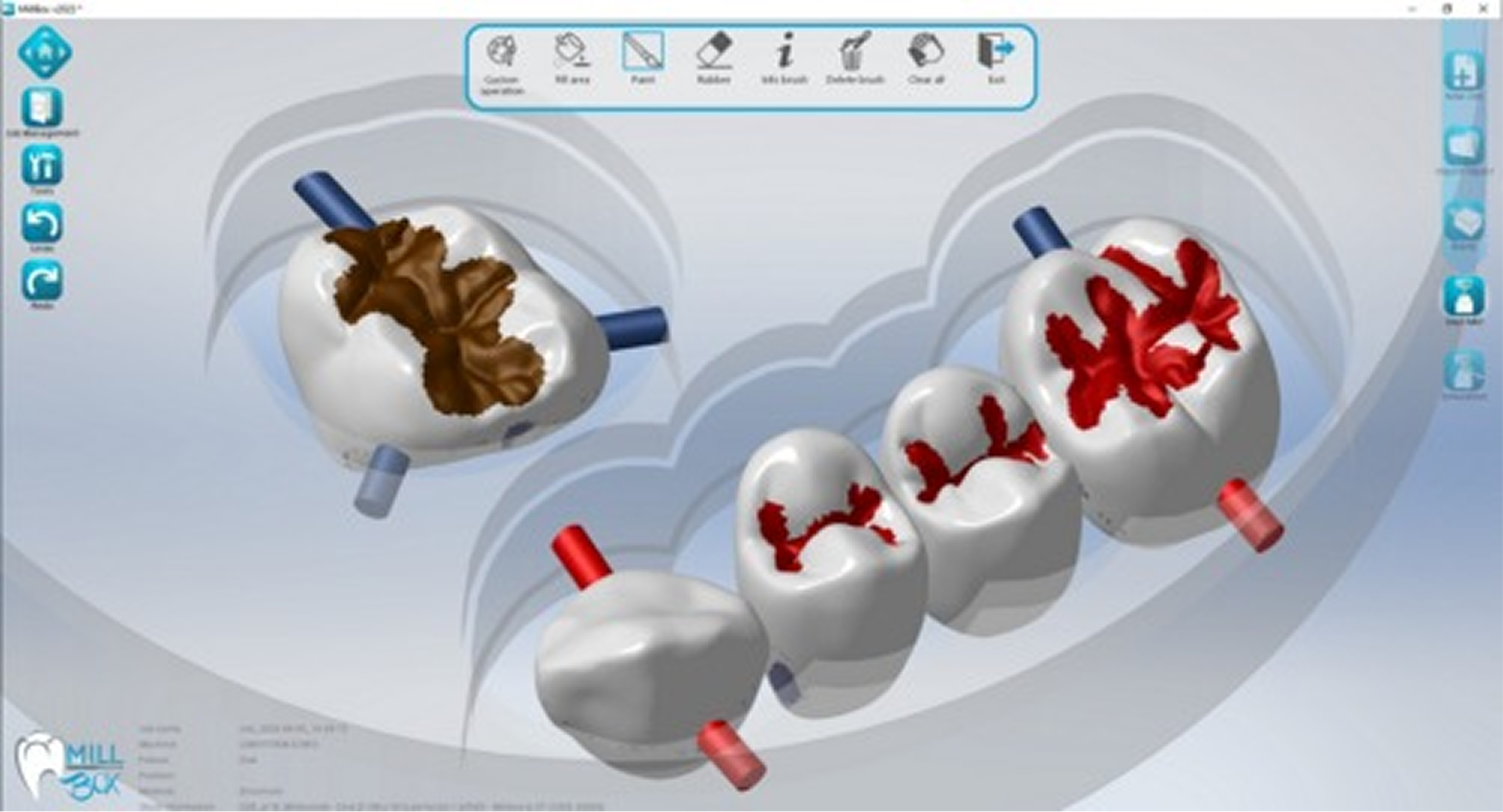 System requirements of Dental CAM MillBox