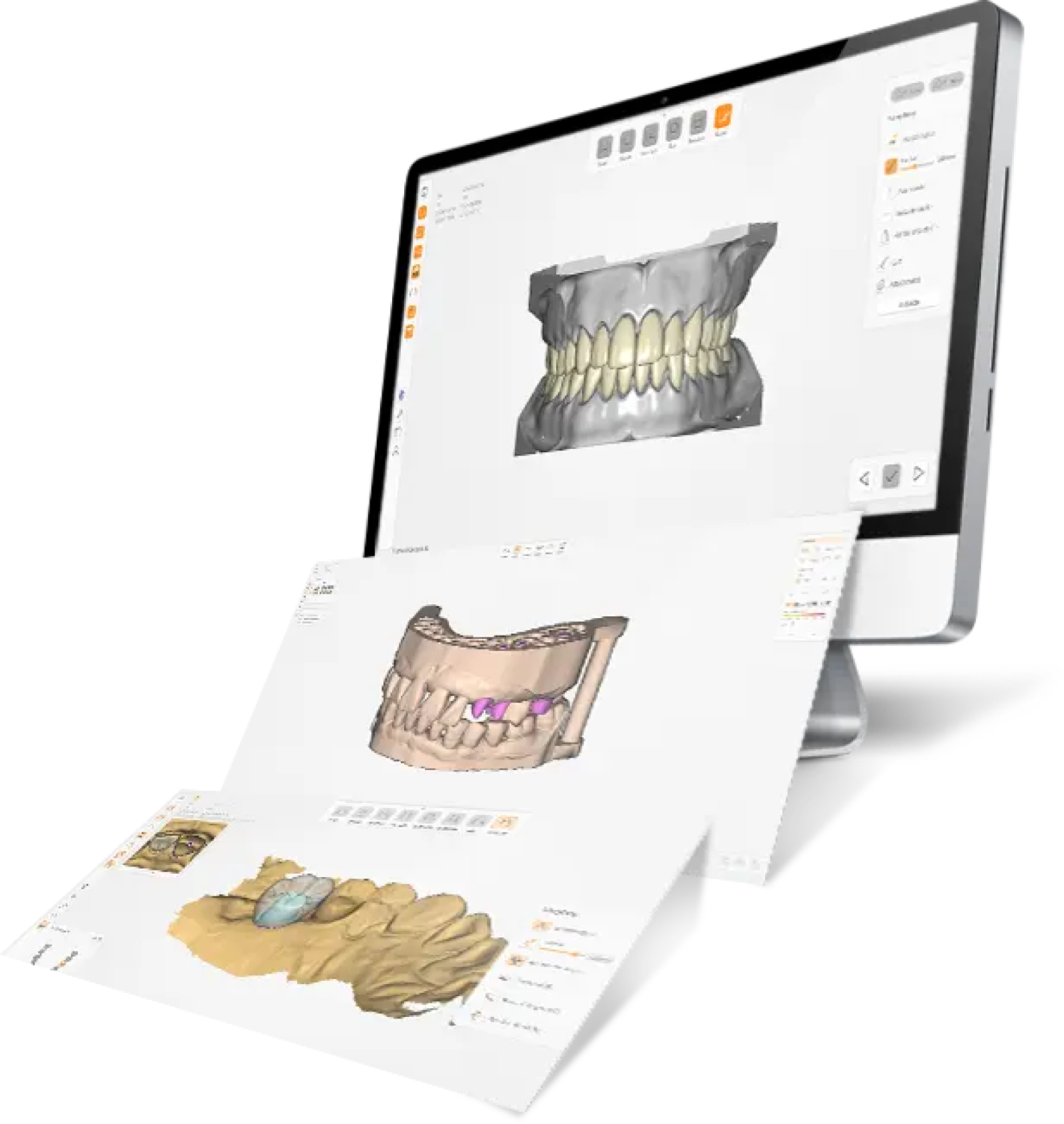 UP3D UPCAD – Dental CAD/CAM Design Software