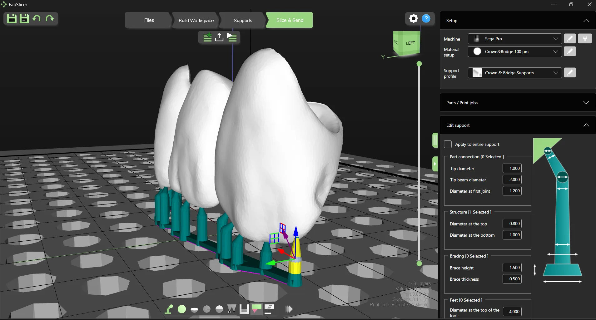 DentaSoft Slicer