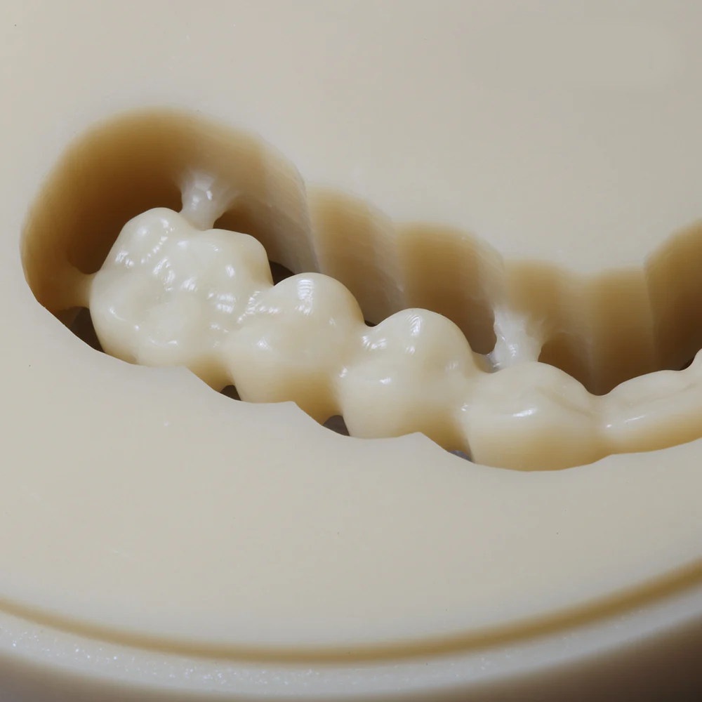 Vincismile NOBILCAM Monolayer PMMA 95MM